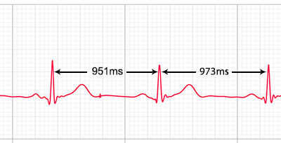 HRV-Heart-Rate-Variability